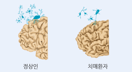 인지장애 클리닉